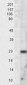 MNSOD / SOD2 Antibody